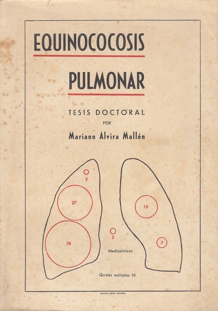 Equinococosis Pulmonar (Tesis Doctoral)