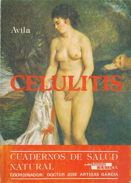 La celulitis y su tratamiento natural