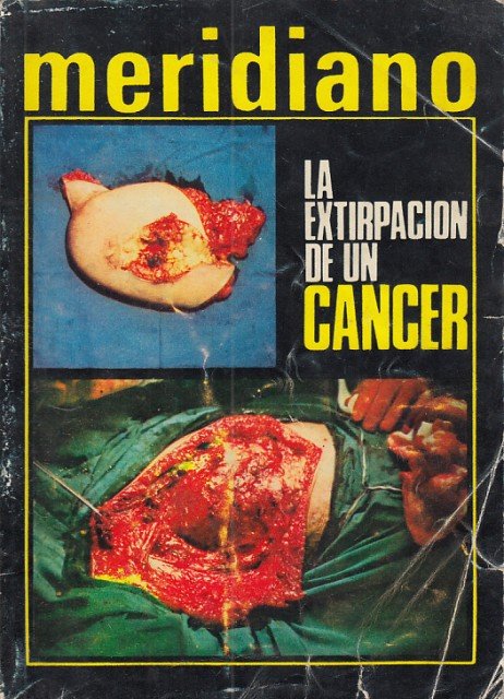 MERIDIANO. SINTESIS DE LA PRENSA MUNDIAL Nº292. LA EXTIRPACIÓN DE … | Immagine principale