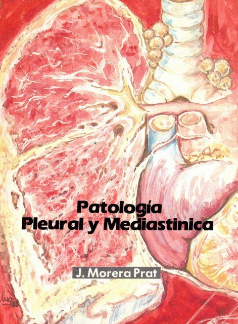 Patología pleural y mediastinica (4 volúmenes)