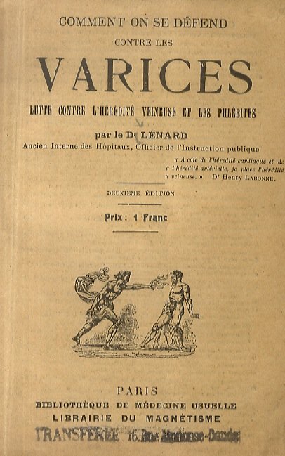 Comment on se dèfend contre le varices. Lutte contre l'héredité …