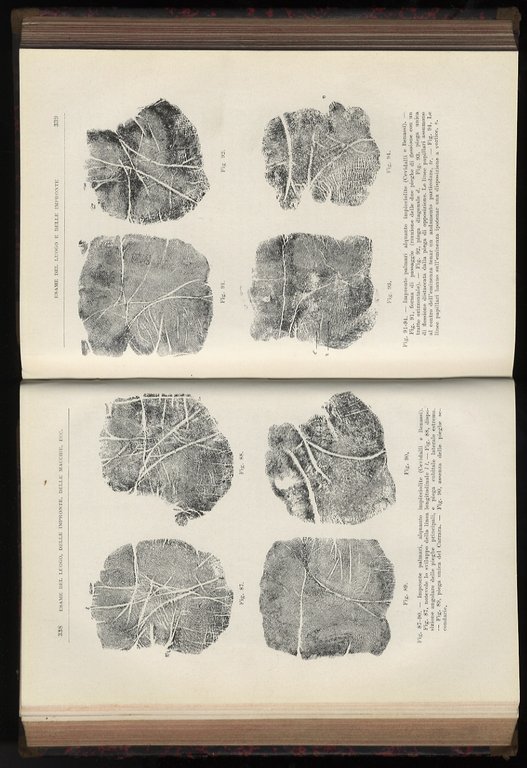 Compendio di medicina legale.