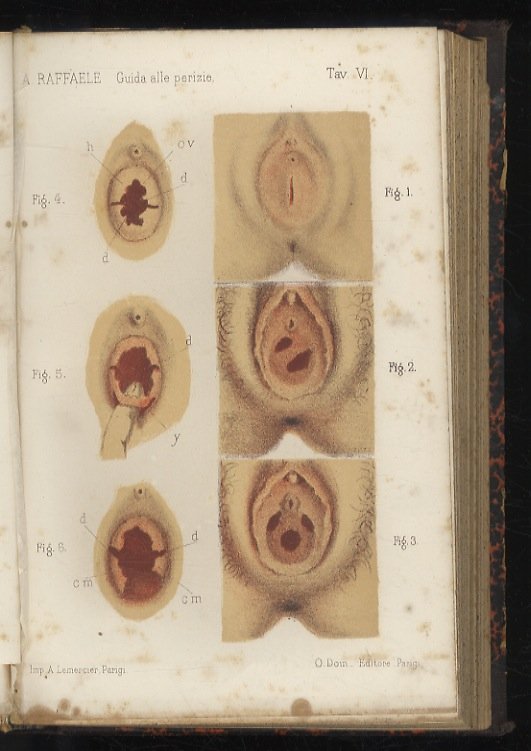 Guida pratica alle perizie medico-legali civili e penali per medici, …