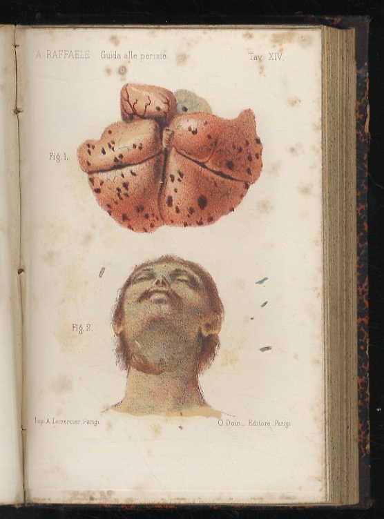 Guida pratica alle perizie medico-legali civili e penali per medici, …