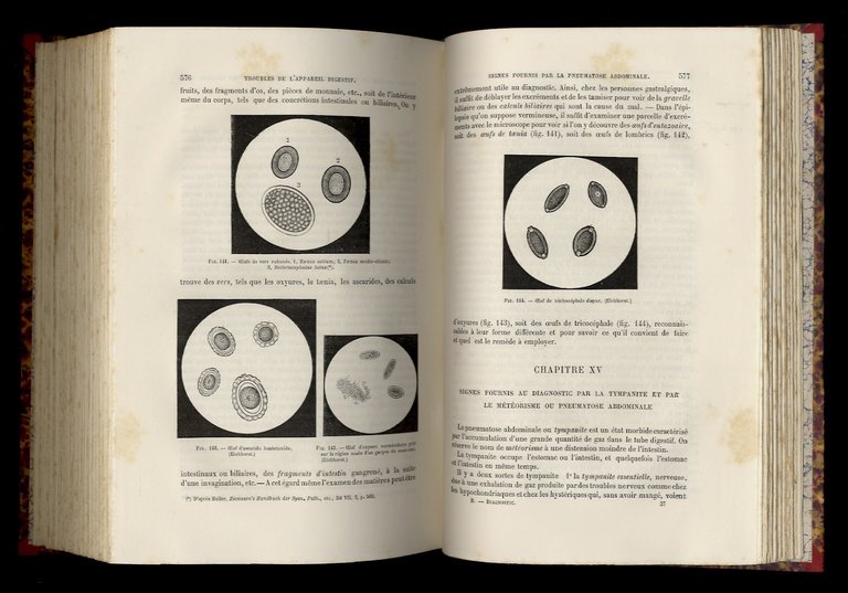 Traité de diagnostic et de sémiologie, comprenant l'exposé des procédés …