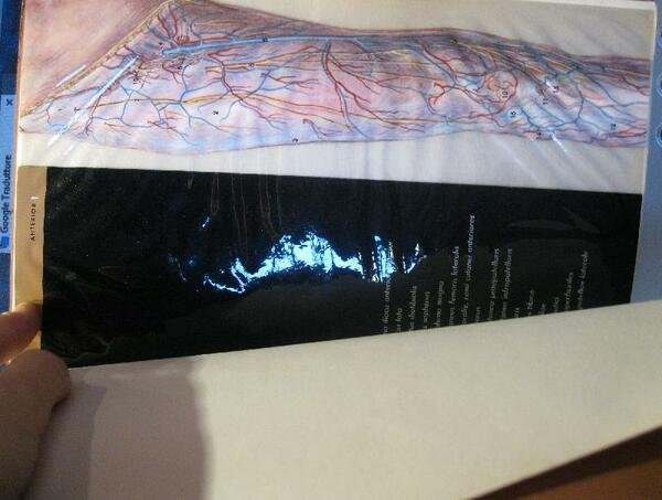 La gamba in trasparenza anatomica. Abbott Laboratoires