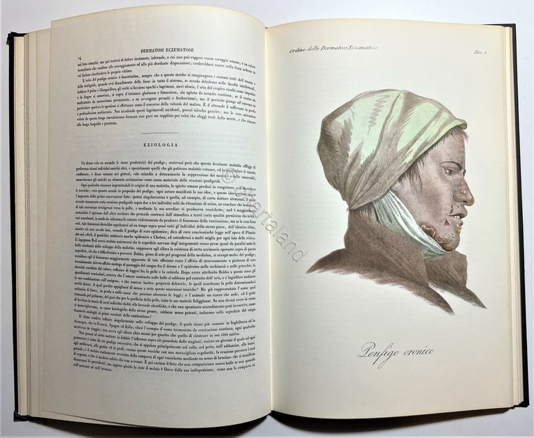 G. L. Alibert - Clinica del Parigino Spedale di San …