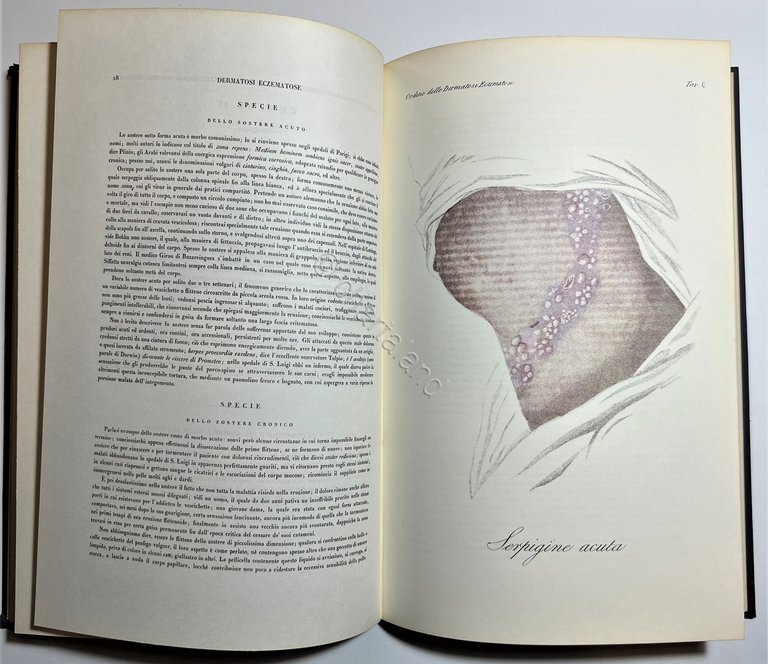 G. L. Alibert - Clinica del Parigino Spedale di San …