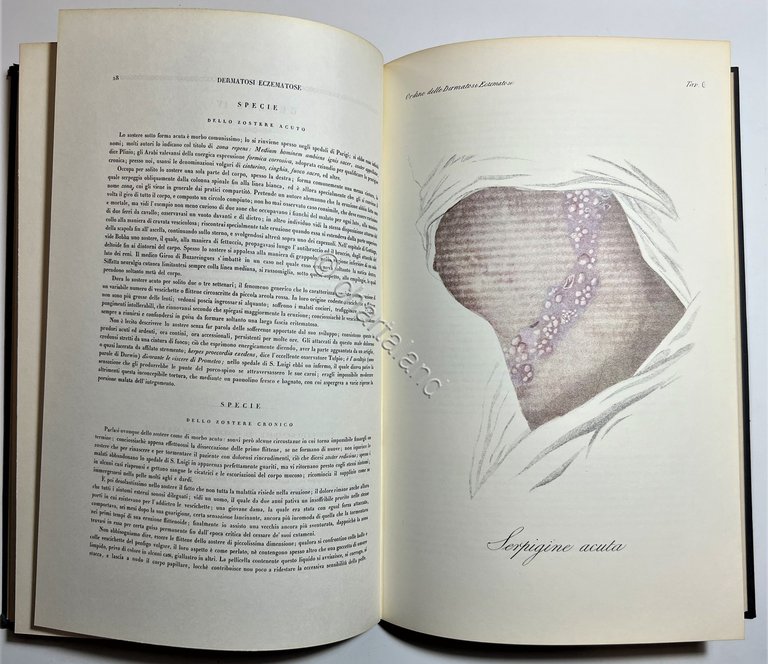 G. L. Alibert - Clinica del Parigino Spedale di San …