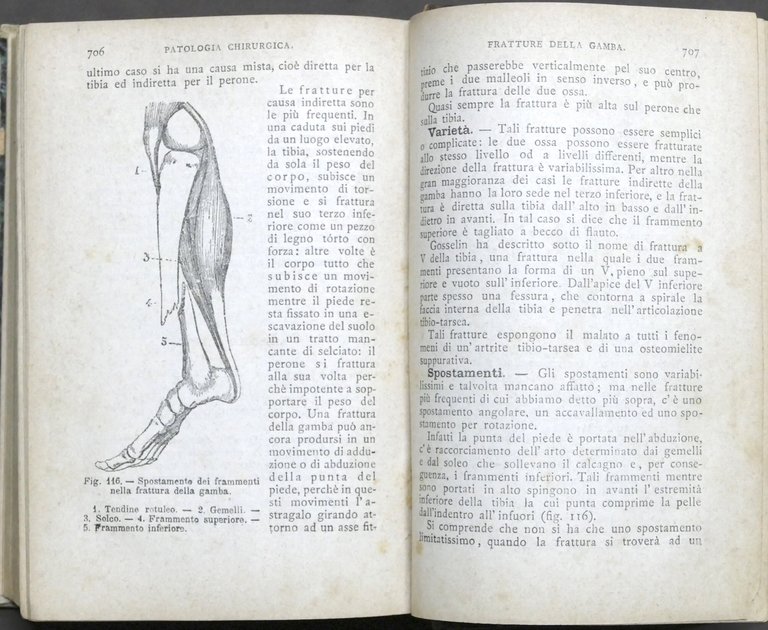 J.A. Fort - Compendio di Patologia clinica e chirurgica - …