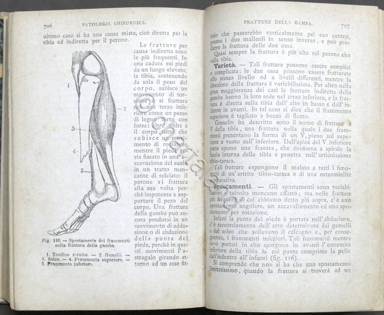J.A. Fort - Compendio di Patologia clinica e chirurgica - …