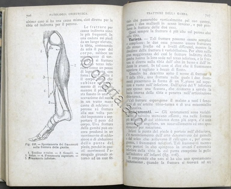 J.A. Fort - Compendio di Patologia clinica e chirurgica - …