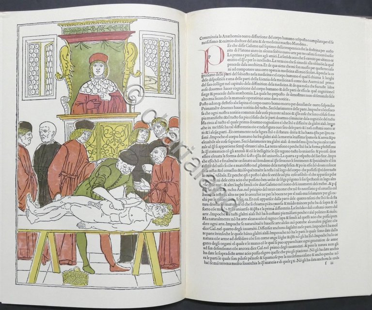 Petrus Montagnana - Fasciculo de Medicina - ed. 1494 - …