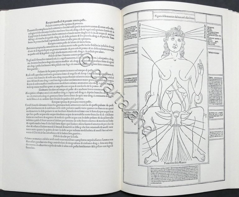 Petrus Montagnana - Fasciculo de Medicina - ed. 1494 - …
