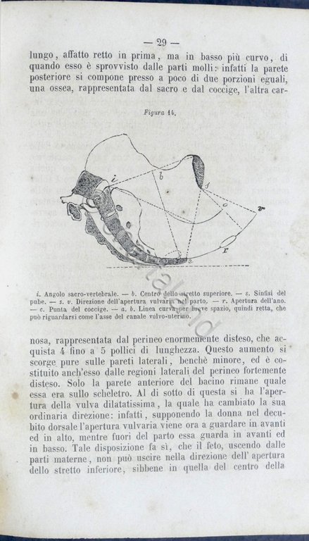 V. Balocchi - Manuale completo di ostetricia ad uso delle …