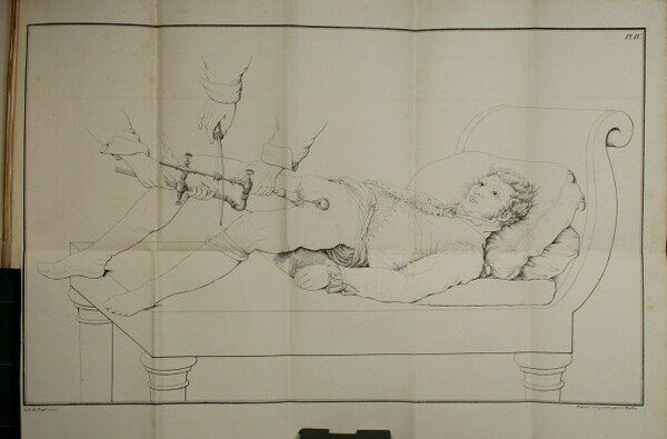 Traité pratique et historique de la lithotritie