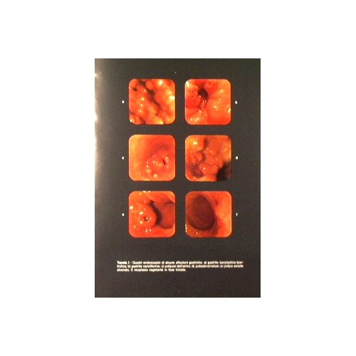 Aggiornamenti di gastroenterologia