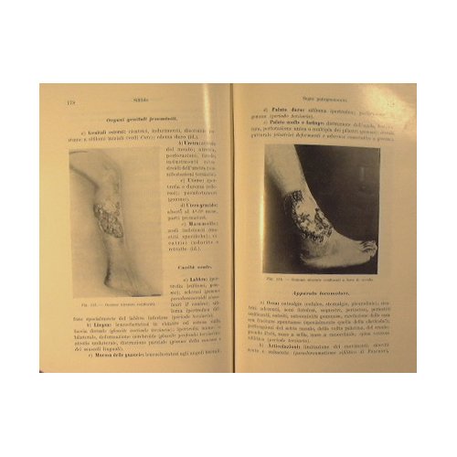 Diagnosi e terapia della Sifilide e delle malattie veneree