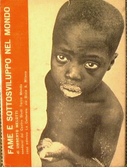 Fame e sottosviluppo nel mondo