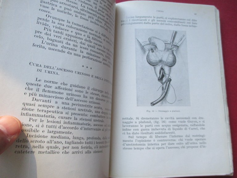 Clinica terapeutica delle malattie urinarie.