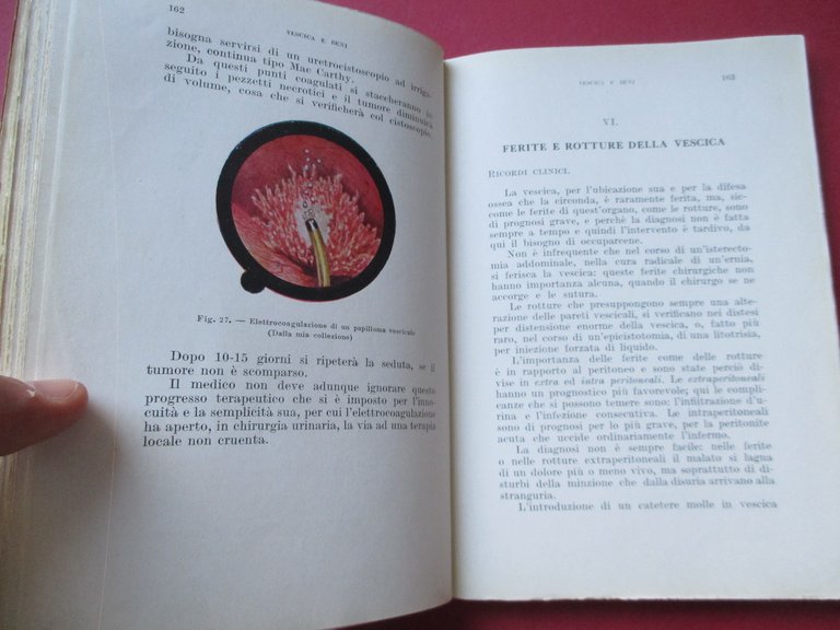 Clinica terapeutica delle malattie urinarie.