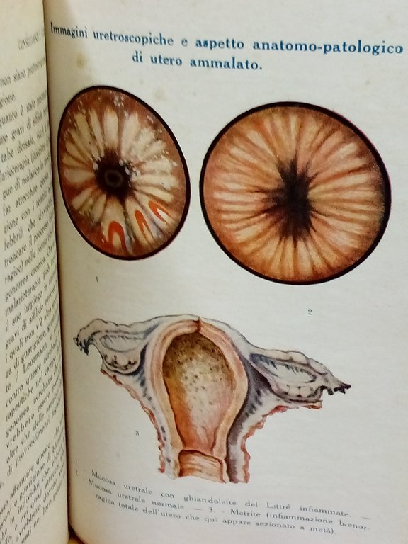 Il pericolo Neisser. Conseguenze e cura della blenorragia. | Immagine Gallery 3