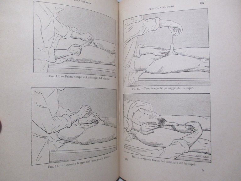 L'infezione gonococcica e le sue complicazioni.