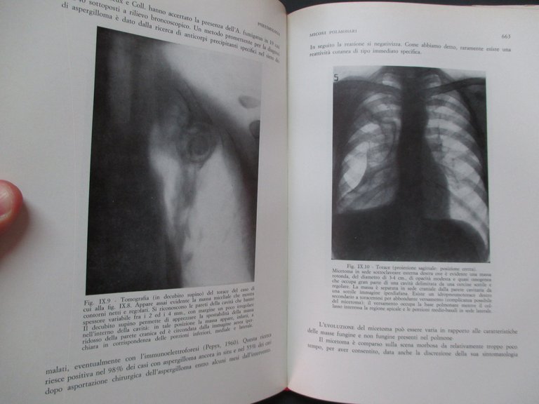 Pneumologia. Volume primo / secondo.