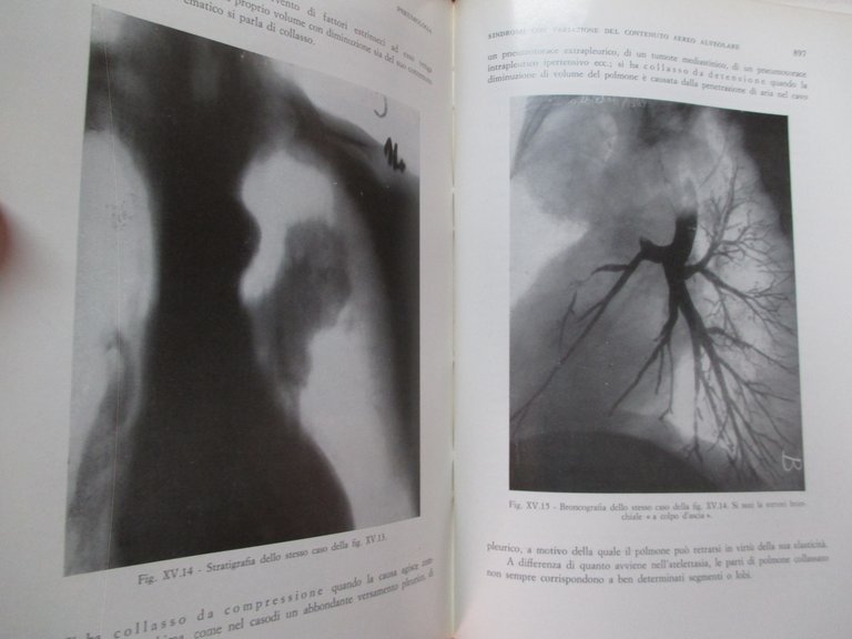 Pneumologia. Volume primo / secondo.