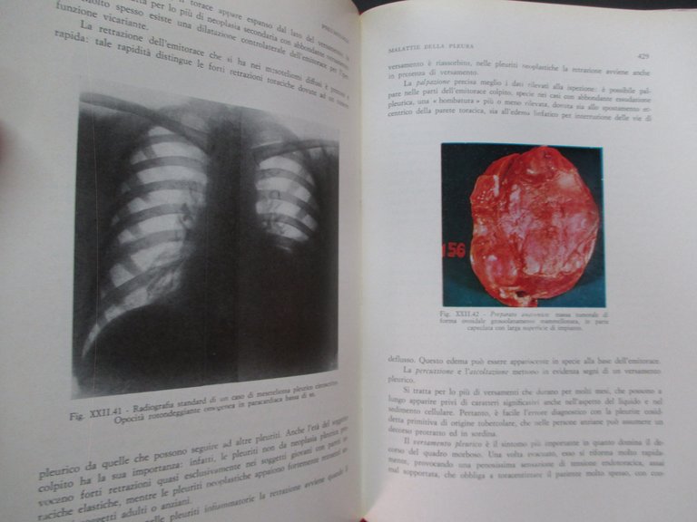 Pneumologia. Volume primo / secondo.