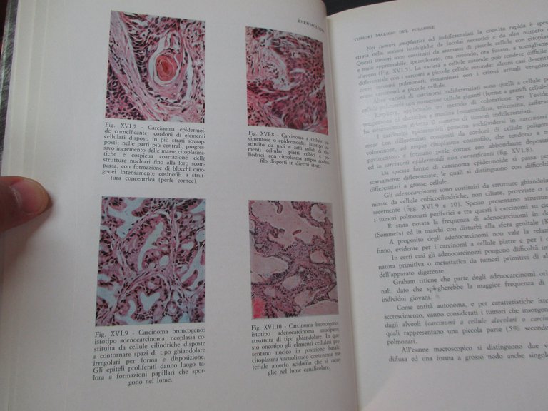 Pneumologia. Volume primo / secondo.