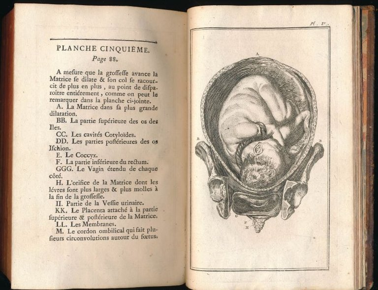 Elémens de l'art des accouchemens augmentés des observations sur les …