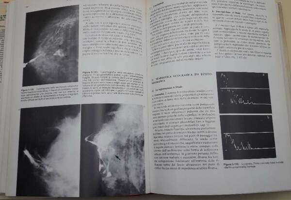 TRATTATO DI SENOLOGIA(1980)