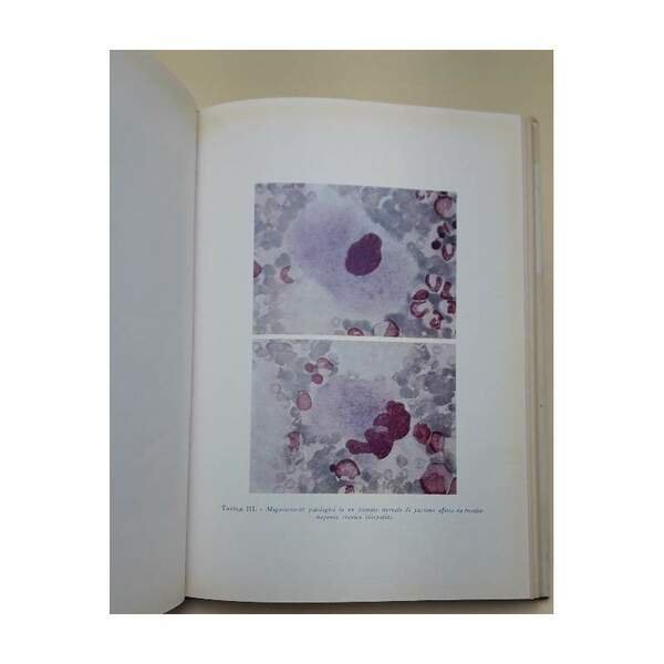 DIAGNOSTICA DI LABORATORIO DELLE MALATTIE EMORRAGICHE( 1971)