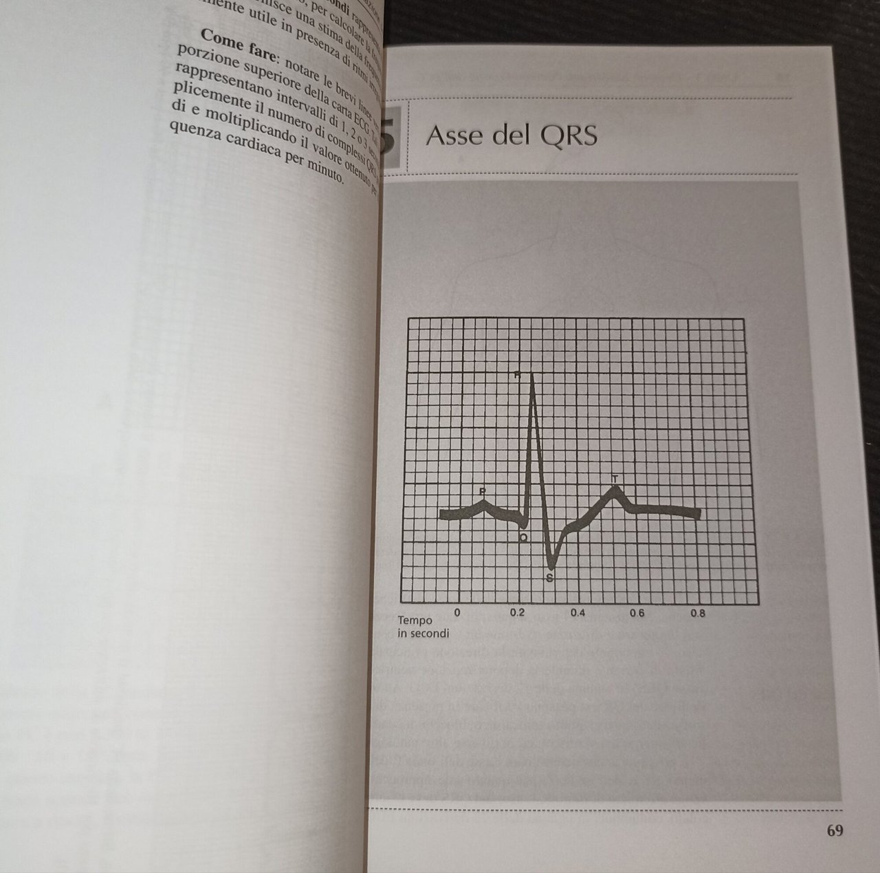 ECG Valutazione e interpretazione