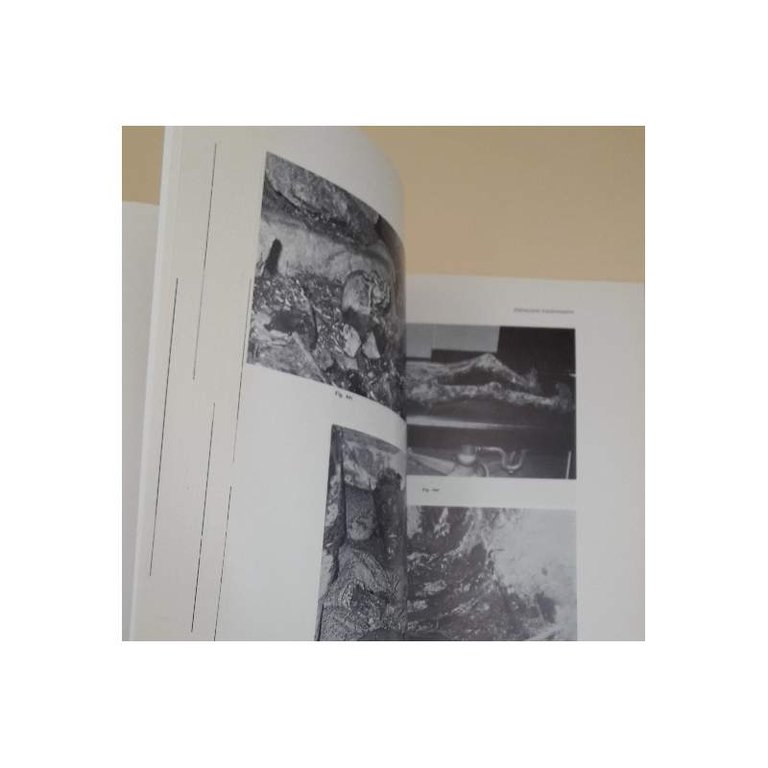 ELEMENTI DI PATOLOGIA MEDICO LEGALE(1981)