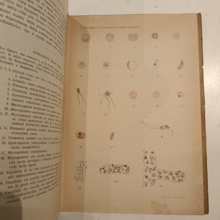 La perniciosità nella malaria | Immagine Gallery 3