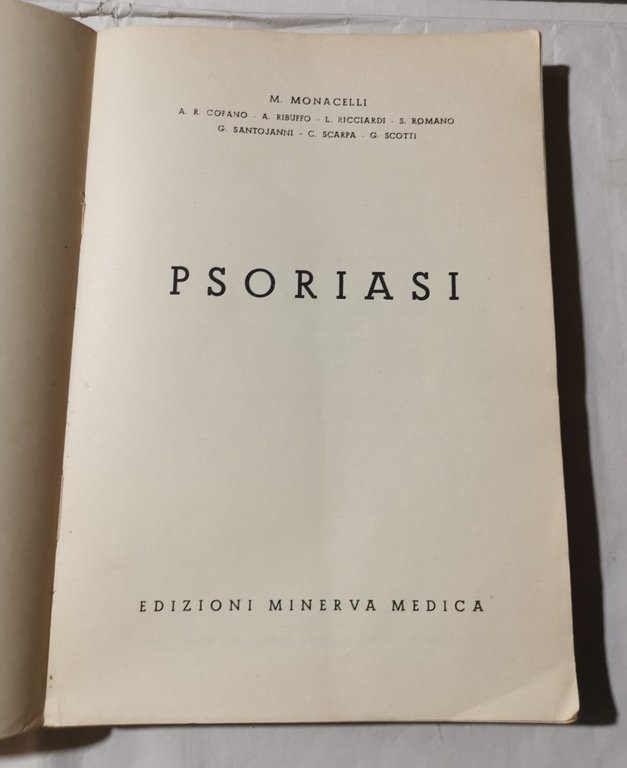 Psoriasi