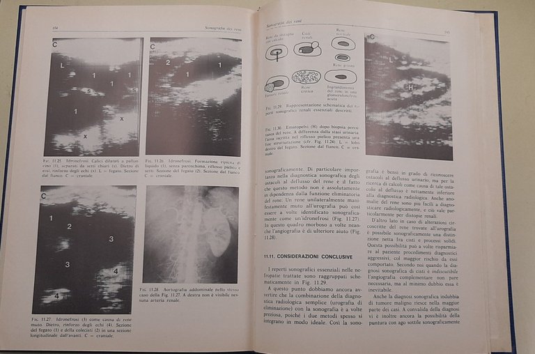 Tomografia Ultrasonica dell'Addome | Immagine Gallery 5