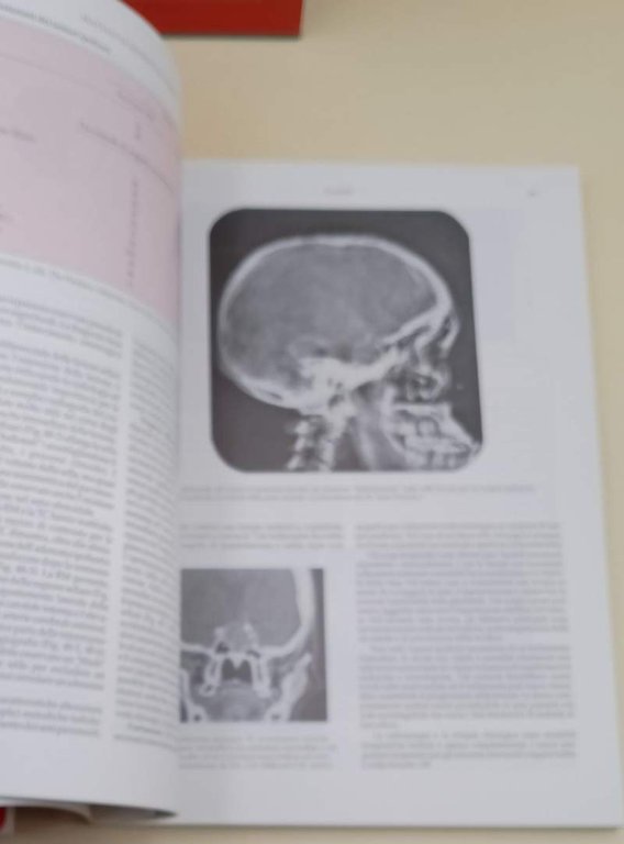 TRATTATO DI NEUROLOGIA MERRITT- 4 VOLL. IN COFANETTO-( 1992)