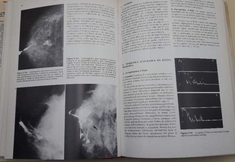 TRATTATO DI SENOLOGIA(1980)