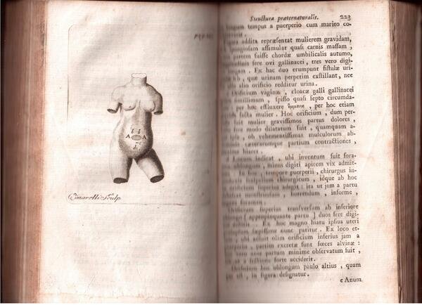 Liber de febribus et alia opuscula varia curante Georgio Christiano …