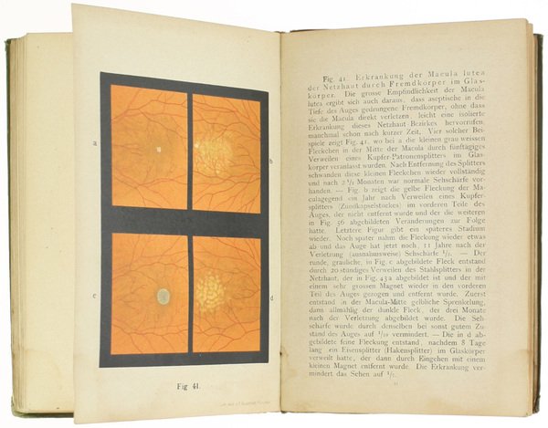ATLAS UN GRUNDRISS DER OPHTHALMOSKOPIE UN OPHTHALMOSKOPISCHEN DIAGNOSTIK.