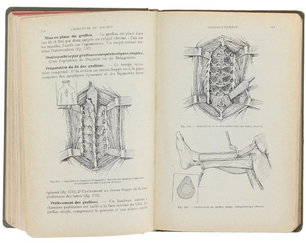 CHIRURGIE DU THORAX ET DU MEMBRE SUPERIEUR. Sixième édition entièrement …