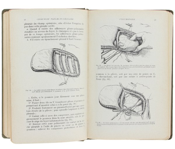 CHIRURGIE DU THORAX ET DU MEMBRE SUPERIEUR. Sixième édition entièrement …