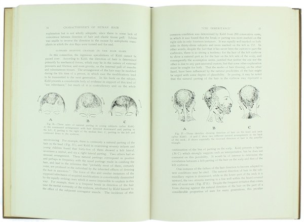 HAIR - With Special Reference to Hypertrichosos.