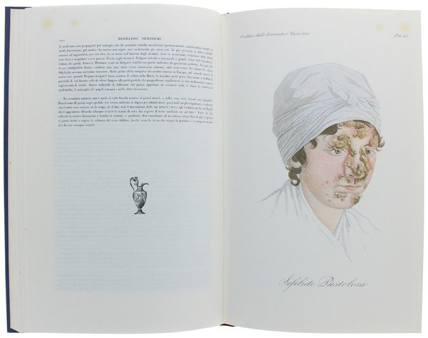 CLINICA DEL PARIGINO SPEDALE DI S. LUIGI OSSIA TRATTATO COMPIUTO …