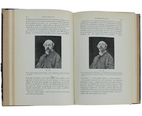 LEÇONS SUR LES MALADIES DE LA MOELLE.