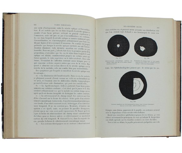 LEÇONS SUR LES MALADIES DE LA MOELLE.