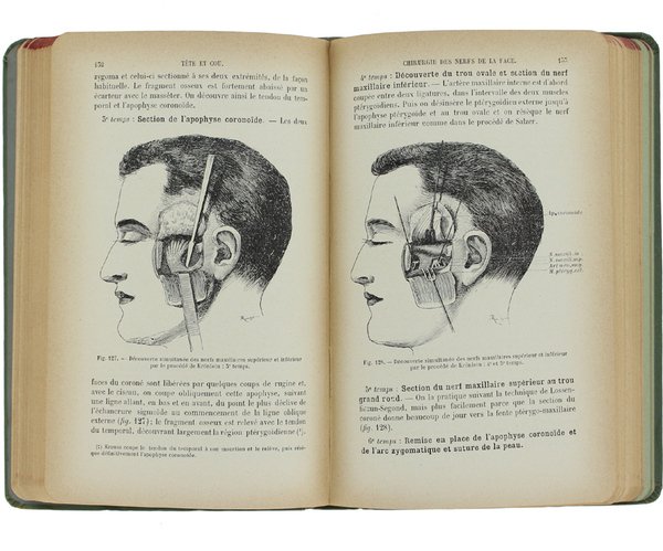 CHIRURGIE DE LA TETE ET DU COU.